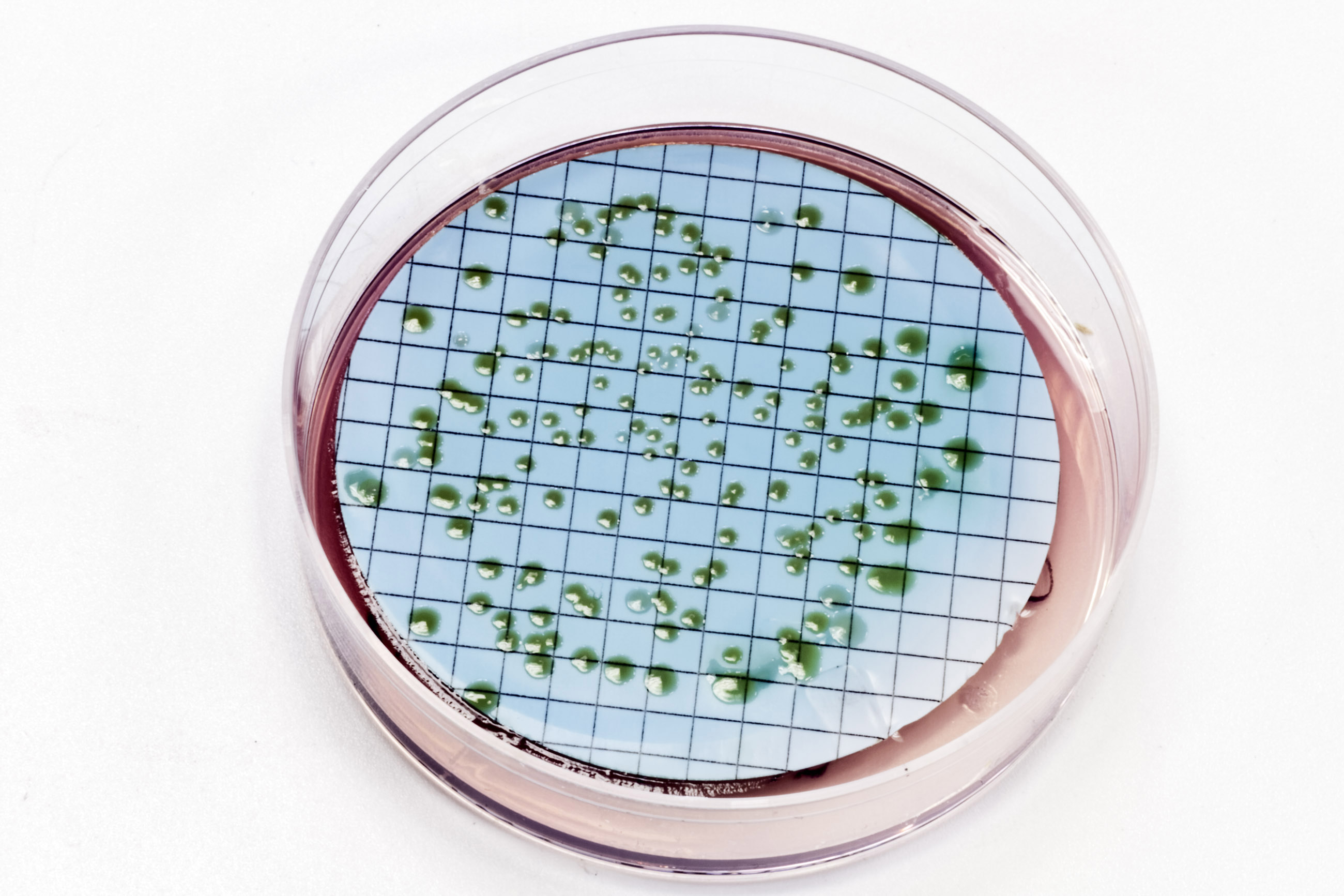 Pseudomonas bacteria on agar plate photo
