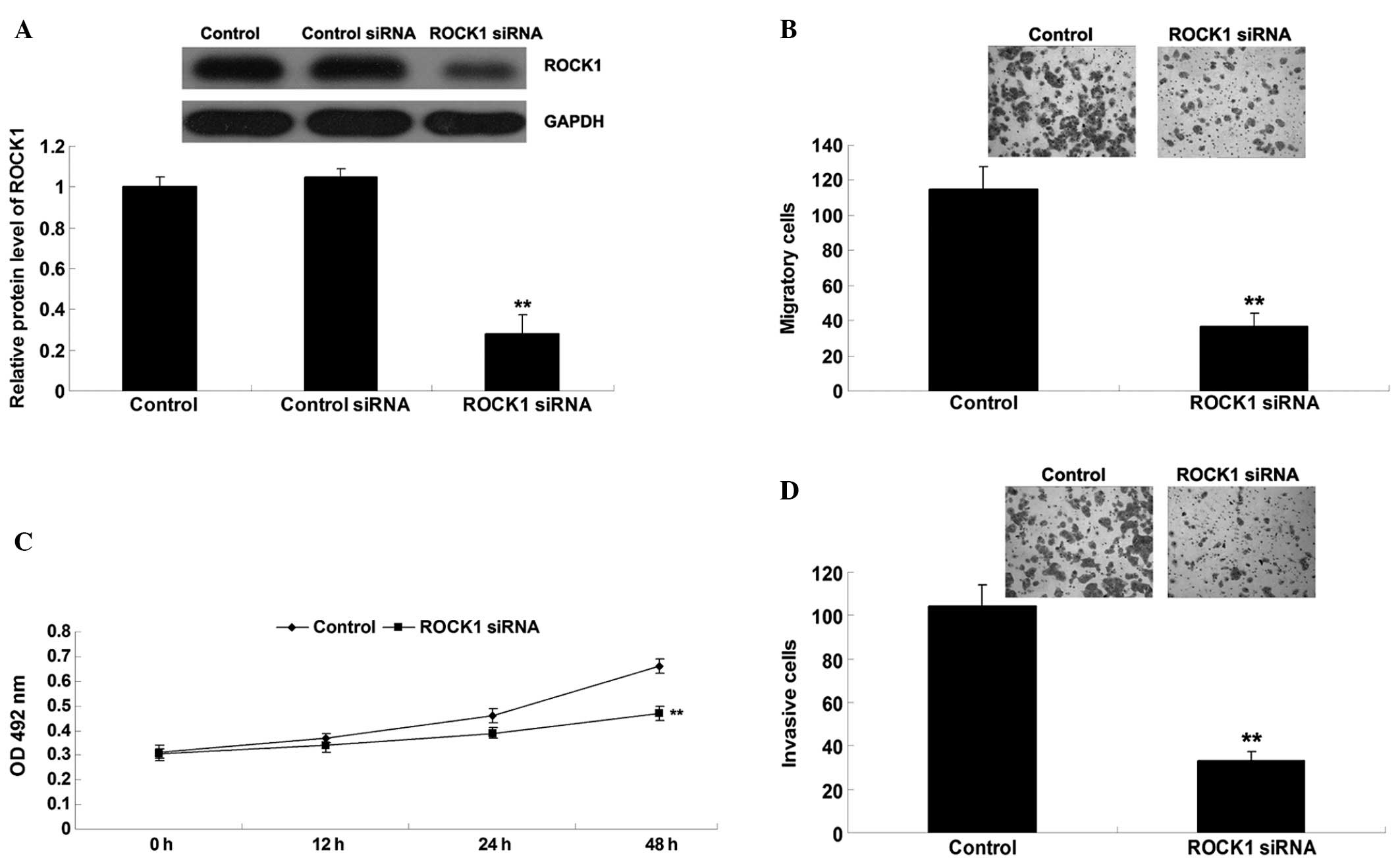 MicroRNA-144 acts as a tumor suppressor by targeting Rho-associated ...