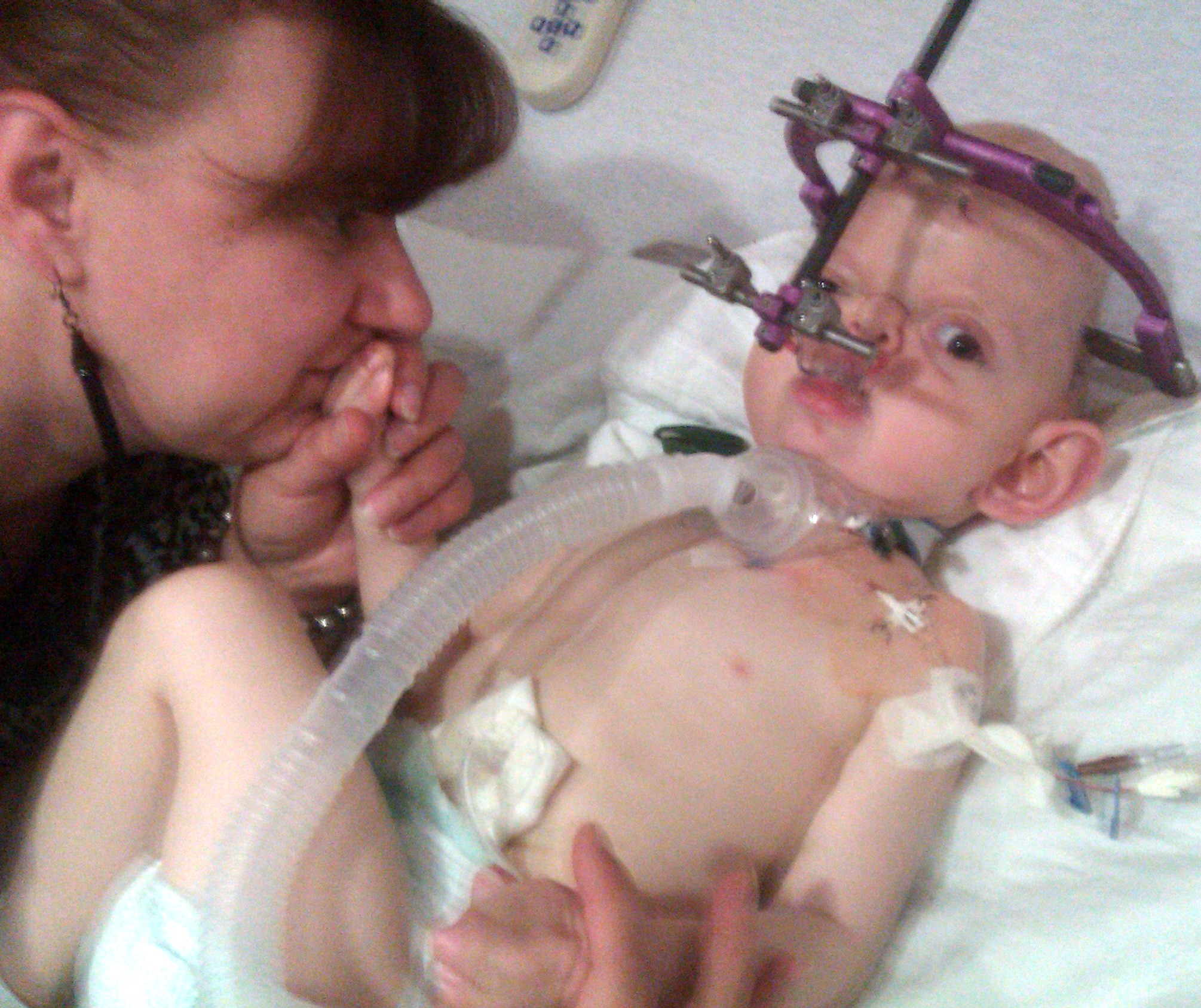 Russian Mother Travels with Toddler to U.S. Seeking Care for Rare ...