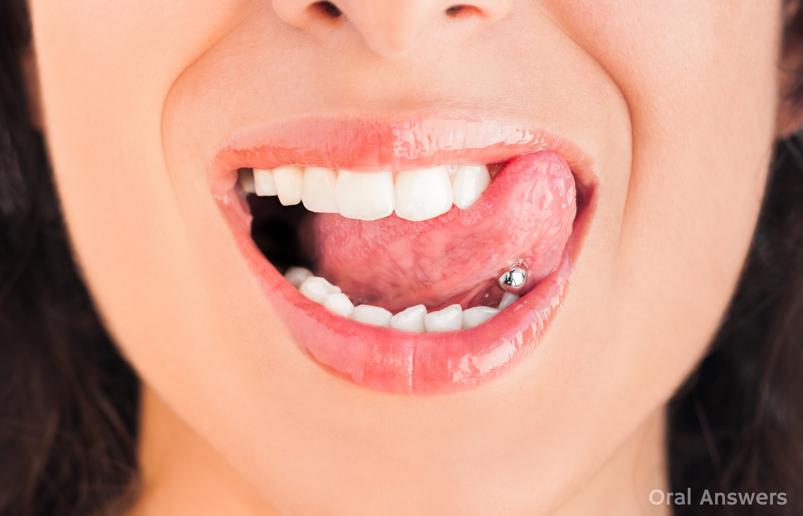 The Risks of Tongue Piercing: 10 Ways It Hurts Your Mouth & Teeth ...