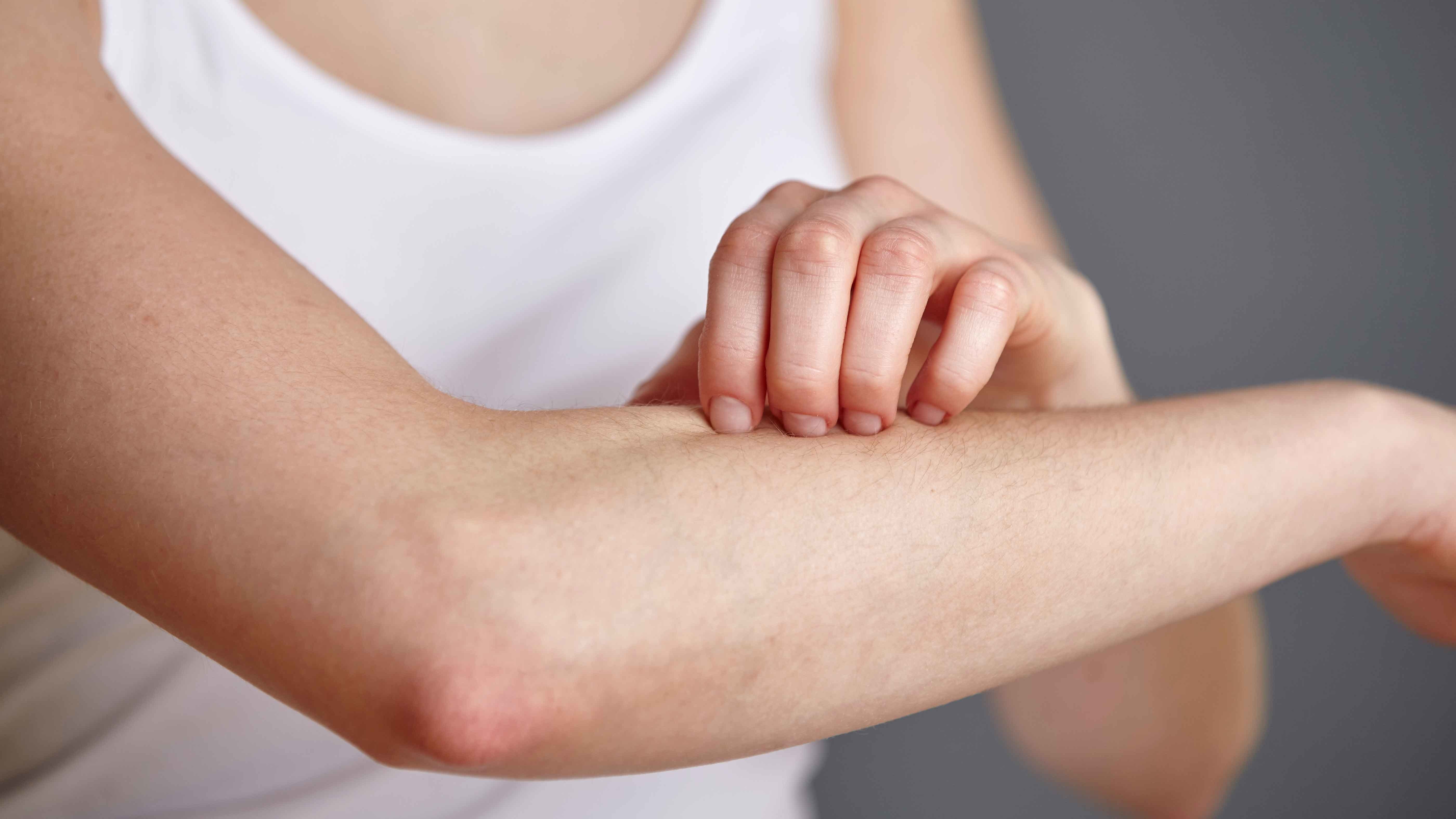 Report Finds Skin Diseases Are More Common Among Americans Than ...