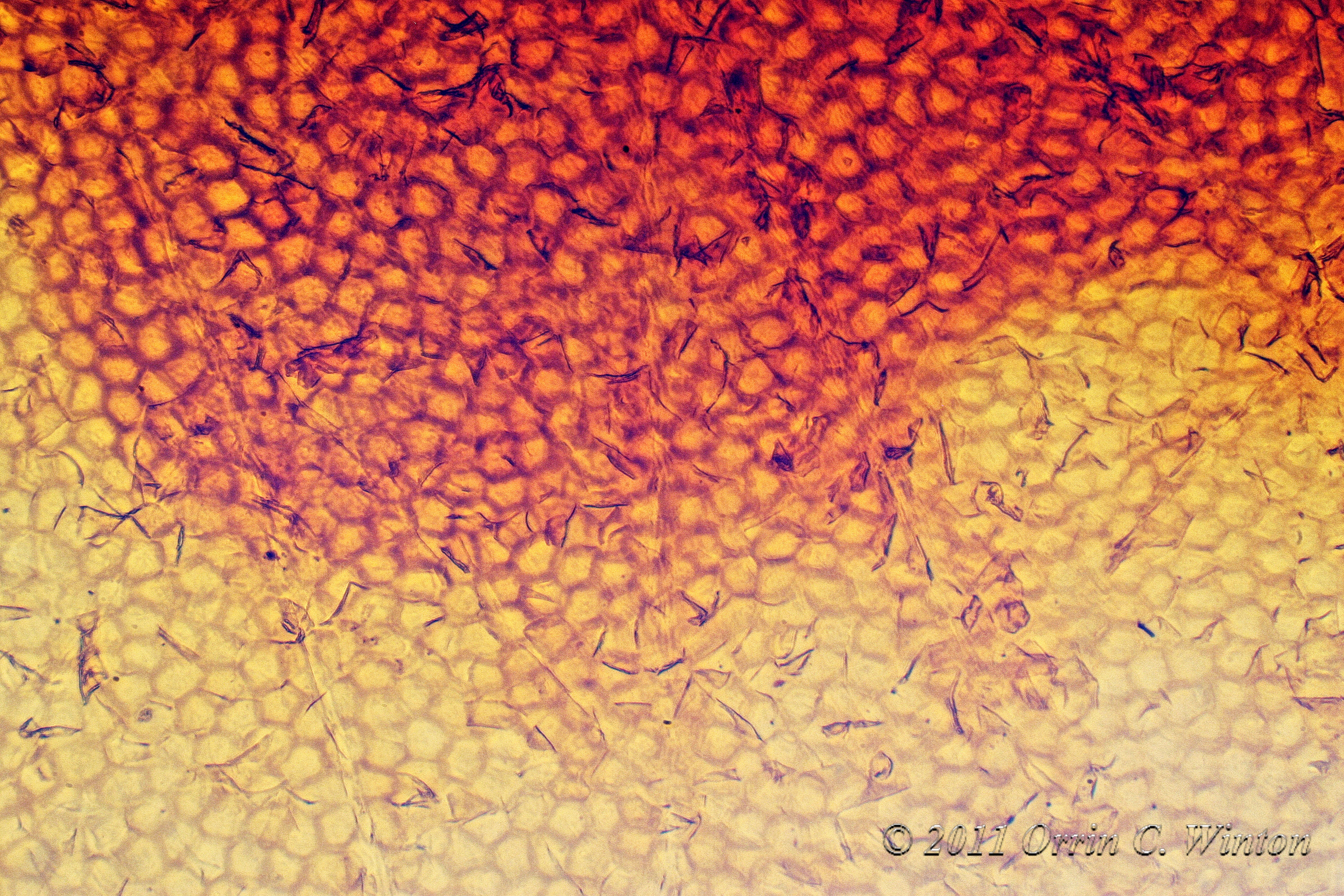 skin-cells-pmax-a | Orrin Winton's Photography