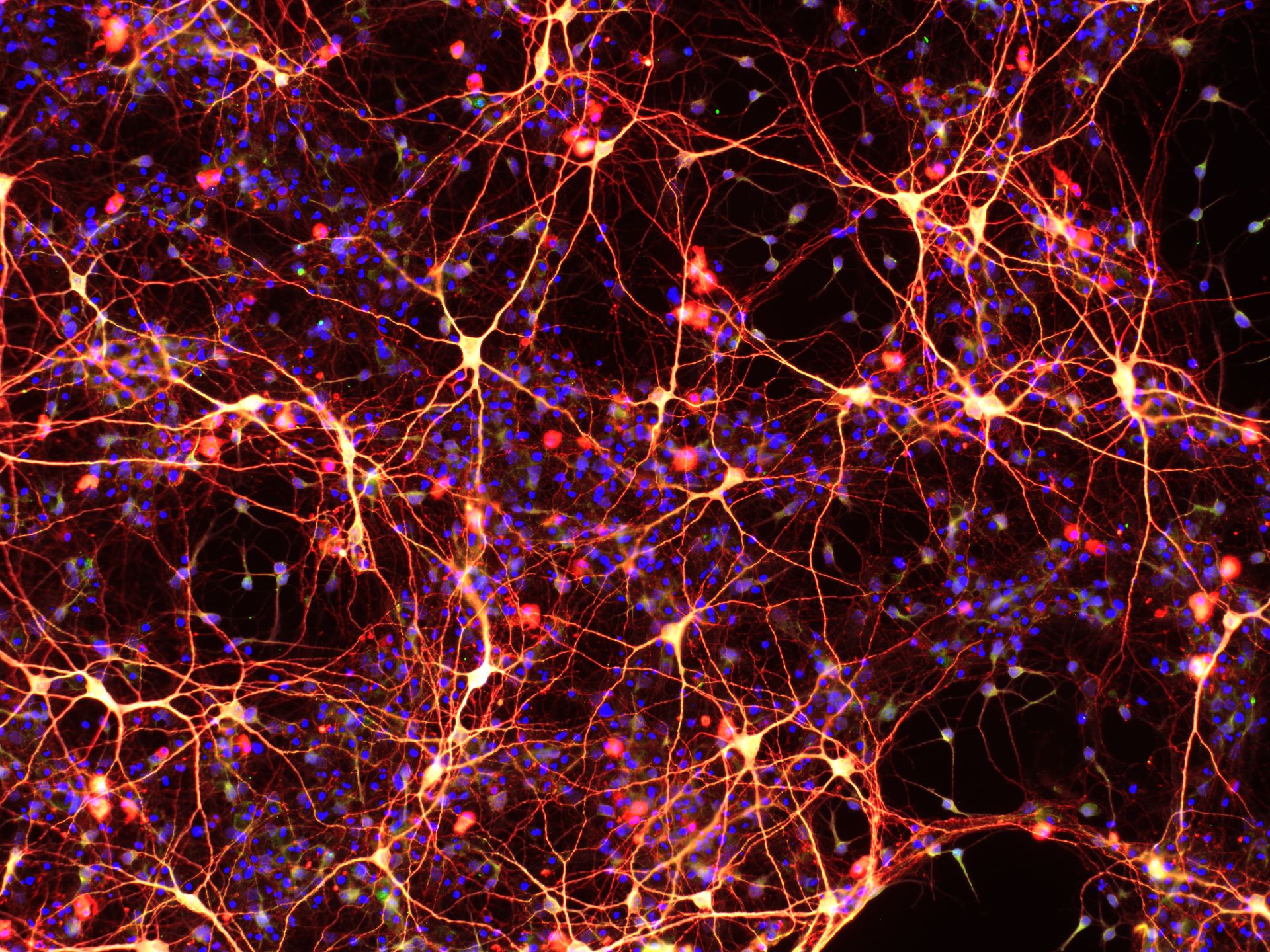 Нейросеть самая красивая. Нейронные клетки головного мозга. Нейронные микросети. Нейрон в нейронной сети. Нейрон клетка головного мозга.