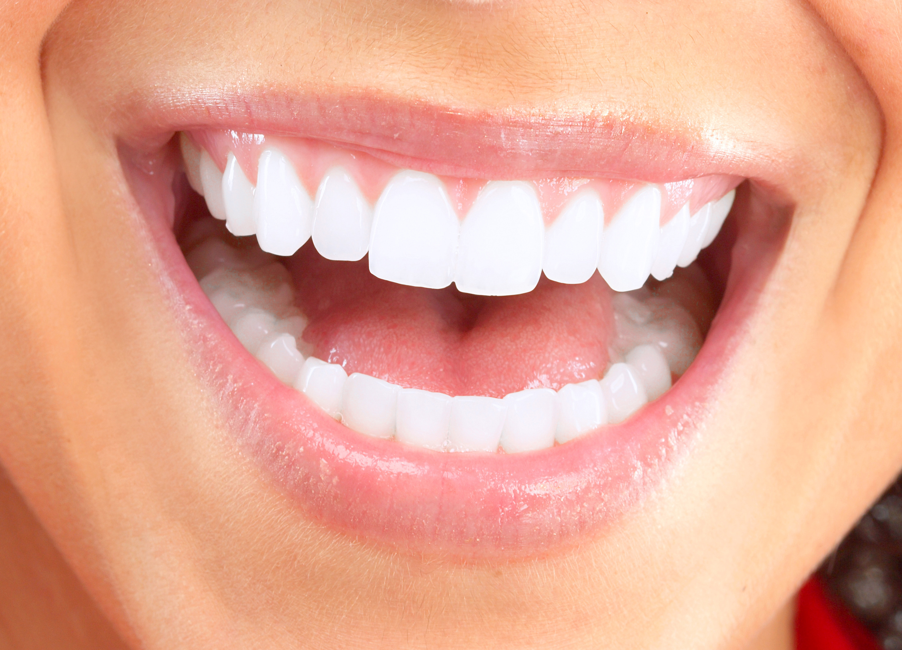 Smile Makeover - Major Dental Clinics