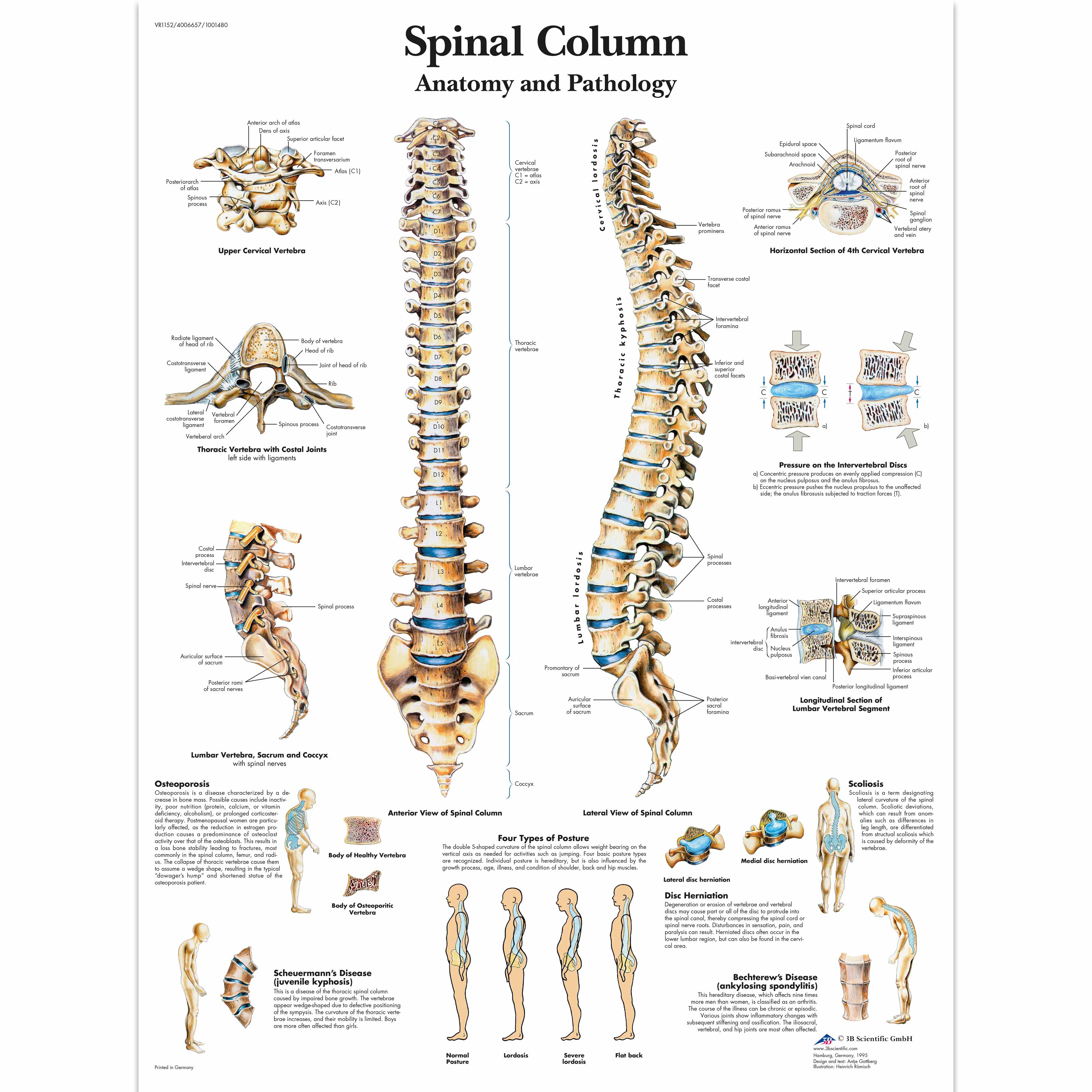 Spinal Column Chart | Vertebrae Posters and Charts | Human Vertebral ...
