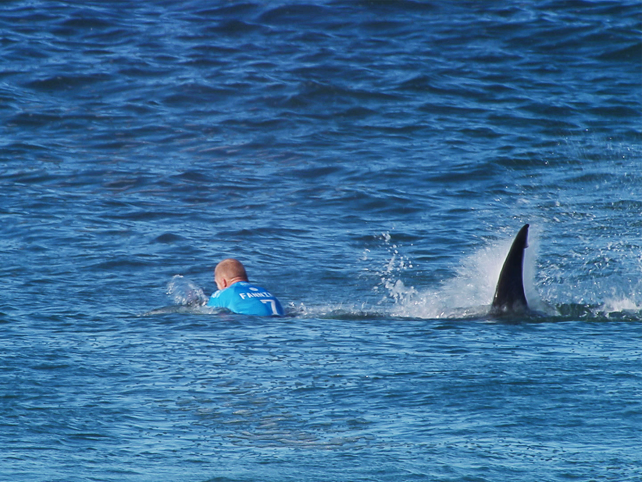 Surfer Attacked by Shark 'Did Everything Right'