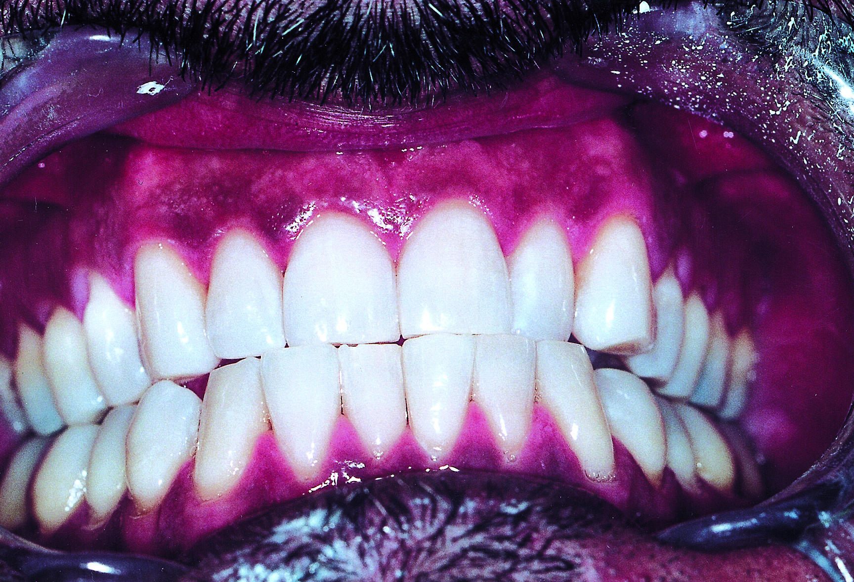 Teeth photo