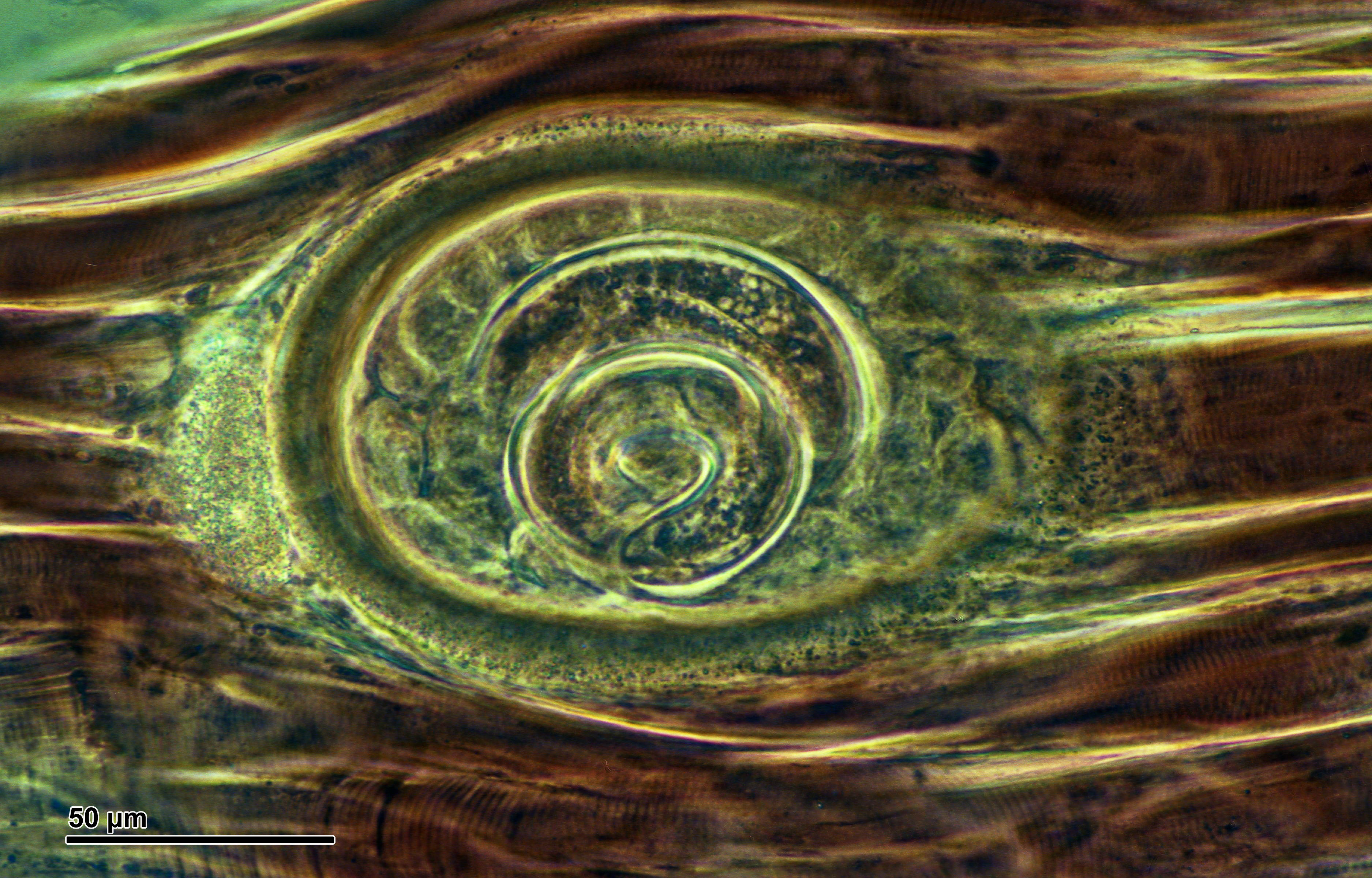 File:Trichinella spiralis in muscle tissue (265 16) In skeletal ...