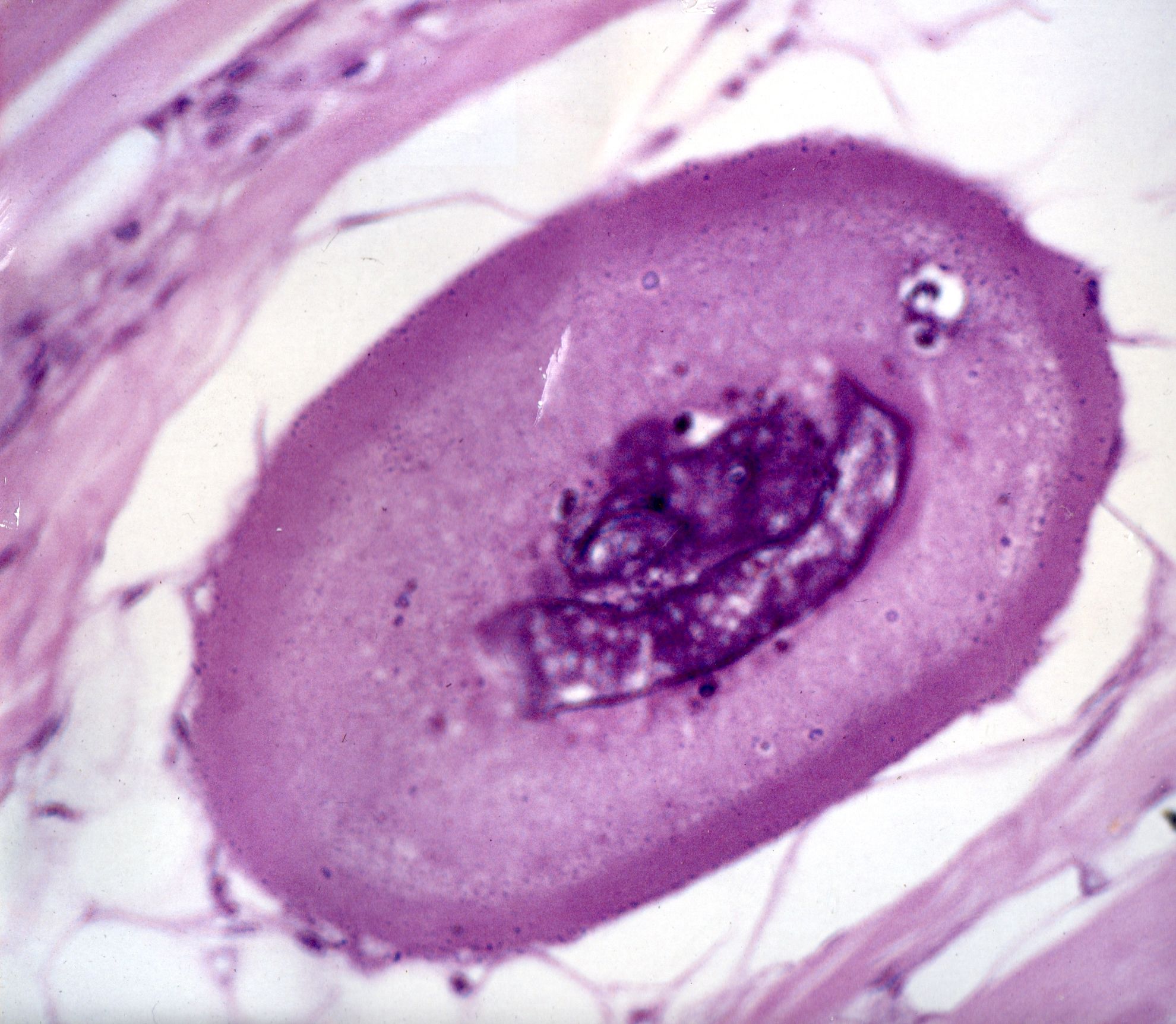 File:Larva de trichinella spiralis img397.jpg - Wikimedia Commons