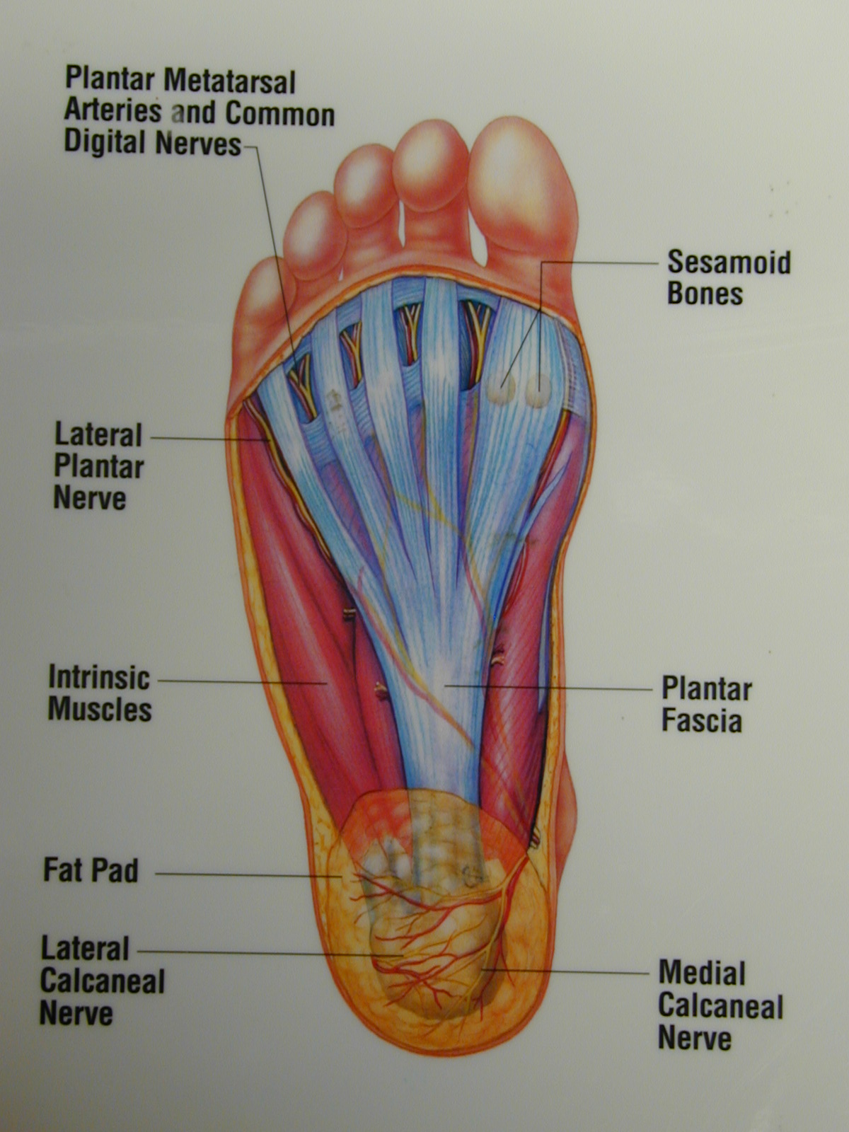 Don't let plantar fasciitis cause you pain after a long winter of ...