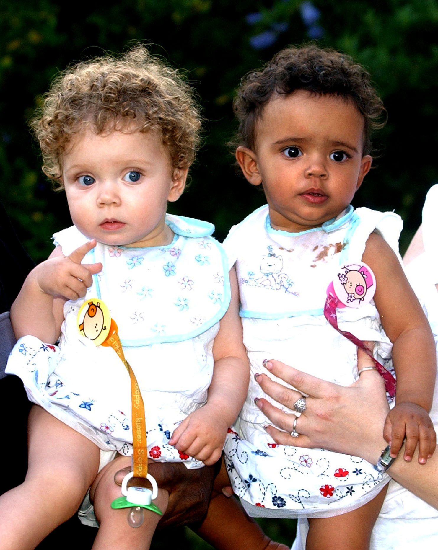 Meet the black and white twins that baffle everyone