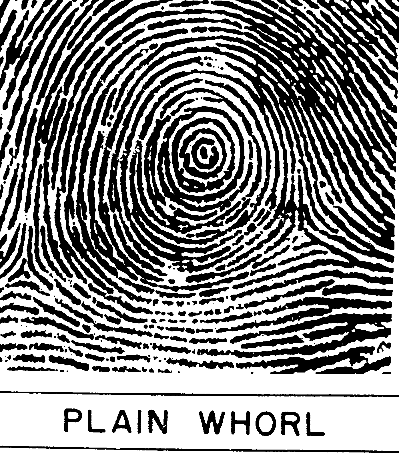 Whorl Fingerprint Archives - American Academy of Hand Analysis