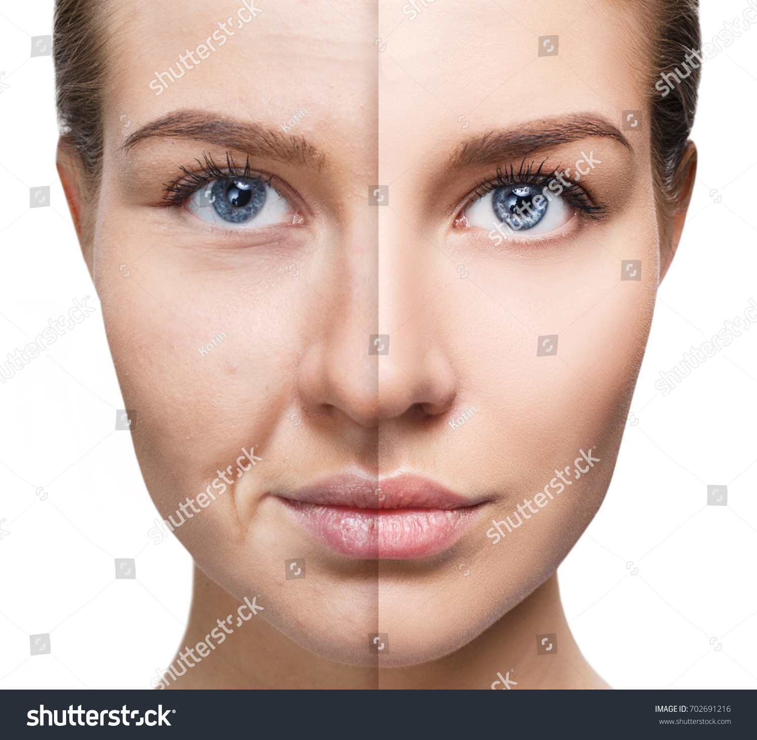 Womans Face Before After Rejuvenation Stock Photo (Edit Now ...