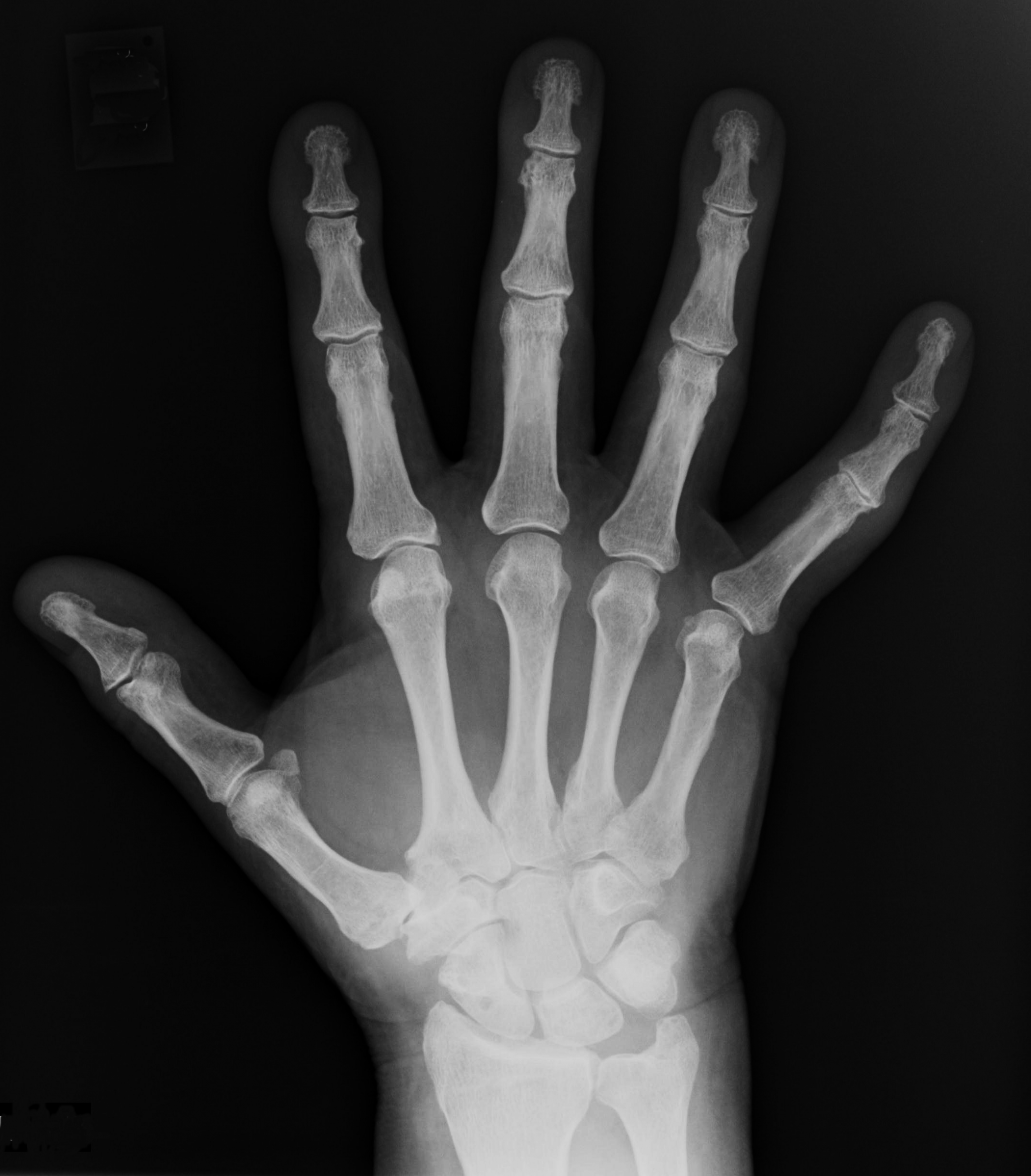 Xray photo