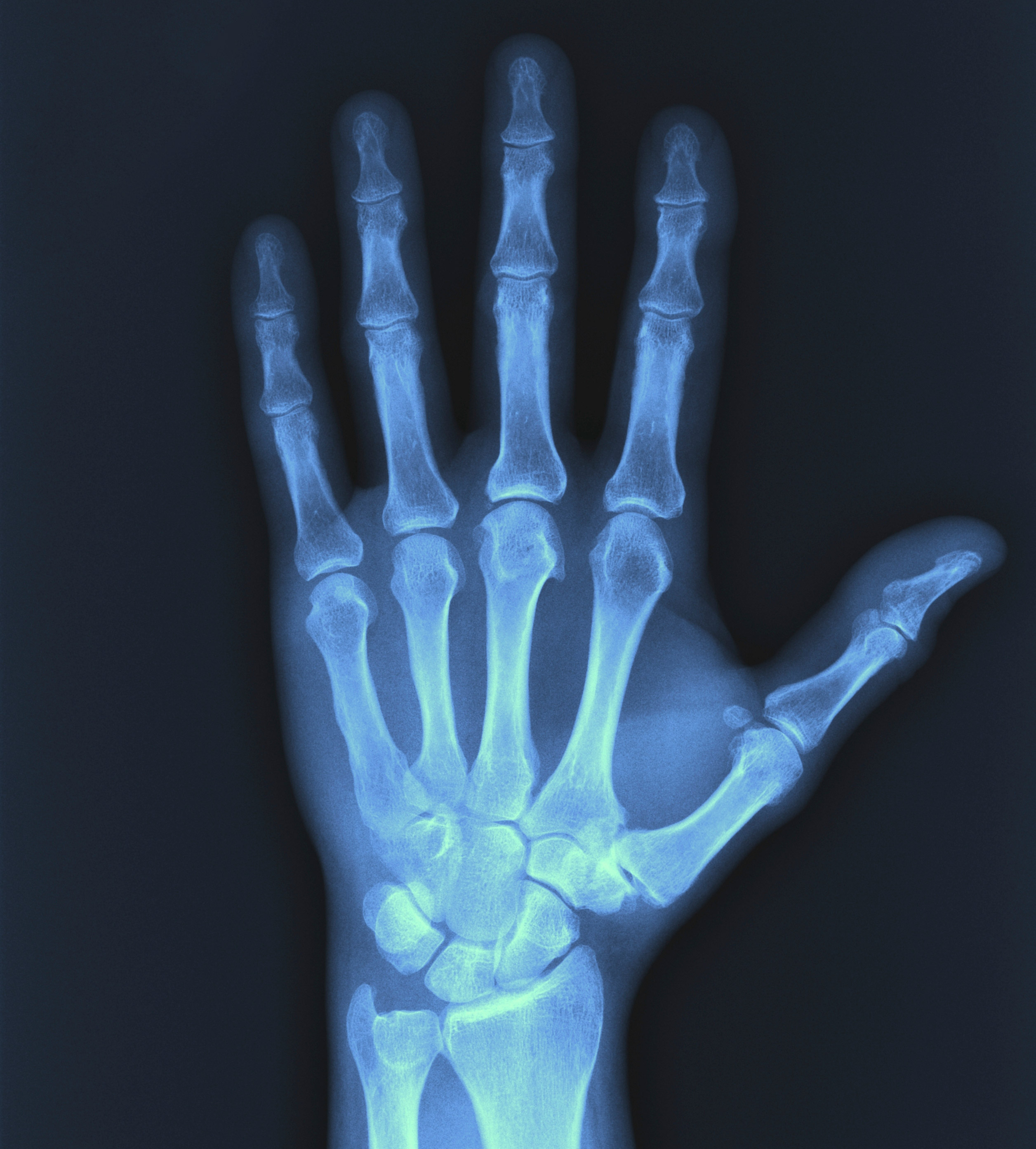 X-Ray | Pulse Medical Imaging