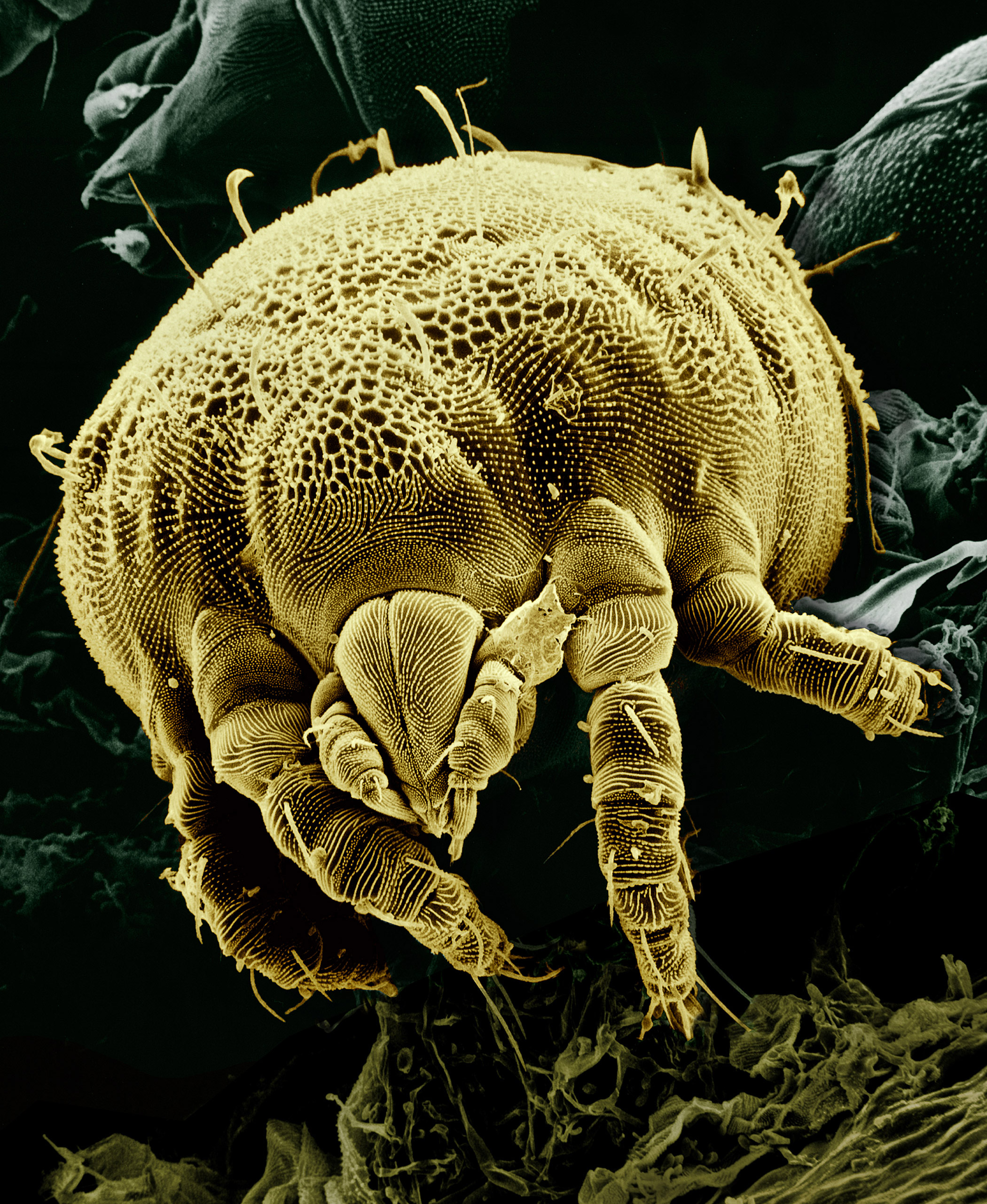 File:Yellow mite (Tydeidae) Lorryia formosa 2 edit.jpg - Wikipedia
