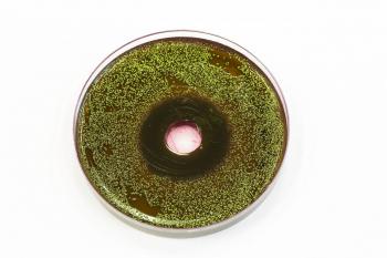 Bacteria growing on EMB agar