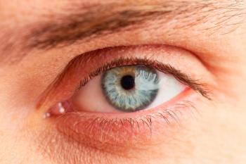 Why Are Some Eyes Blue? | Reader's Digest