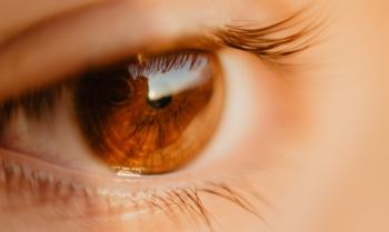 Close-up Photo of Unpaired Brown Eye