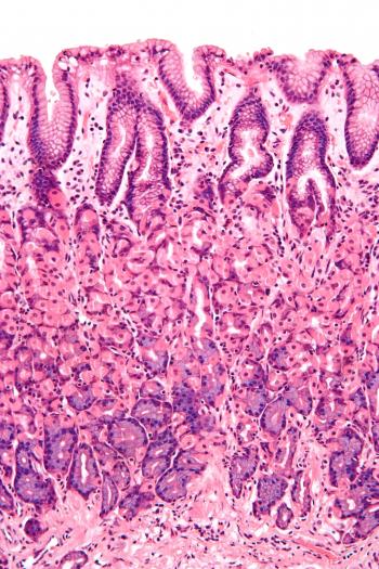 Simple columnar epithelium - Wikipedia