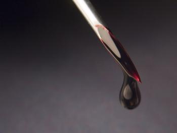 File:Drip.jpg - Wikimedia Commons