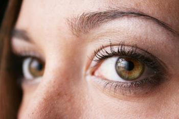 File:Hazel-green eye 2.jpg - Wikimedia Commons