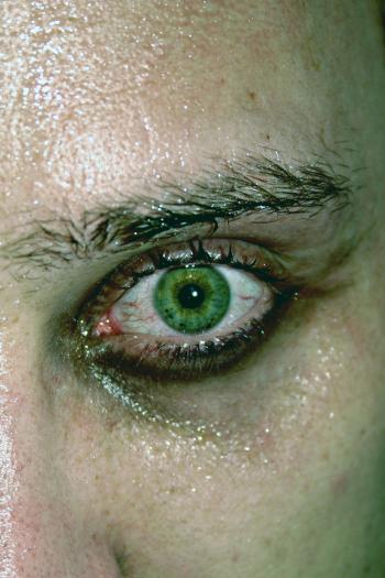 Green eye