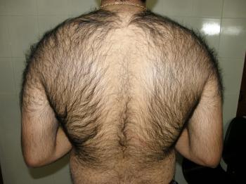 How Hairy Men Can Take Care Of Their Skin -