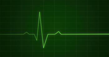 Concept animation of an ECG or EKG heartbeat cardiogram on a green ...