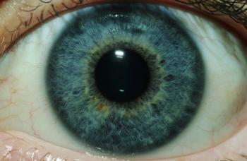 Digital SLR Iris Photography System - healthquestsoftware.com.au