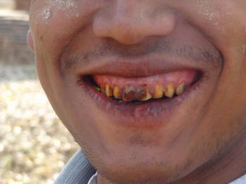 No Spitting Of Momma" - Betel Nut Expained. | NivenWorldAdventures!