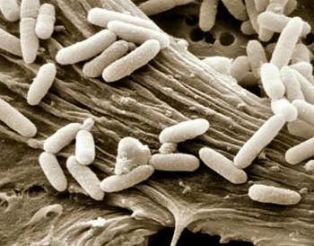 Why does the bedding whose germs were removed thermally has a great ...