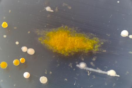 Bacteria growing on a perti dish.