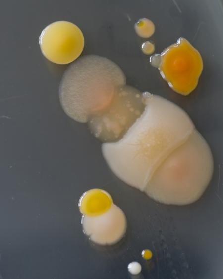 Bacteria growing on a Perti dish