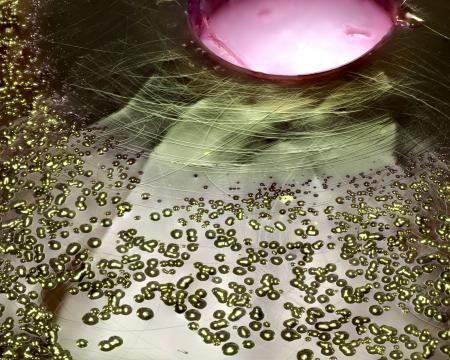 Bacteria growing on EMB agar