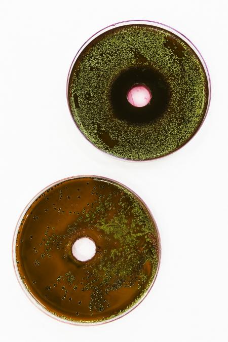 Bacteria growing on EMB agar