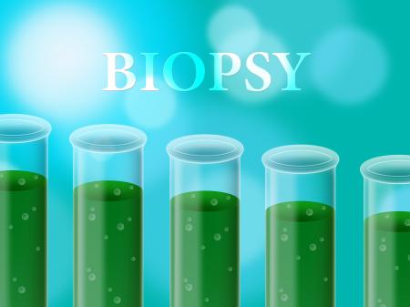 Biopsy Test Means Researched Laboratory And Analyse