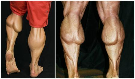 Calves