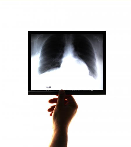 Doctor examining and holding an x-ray image in his hand