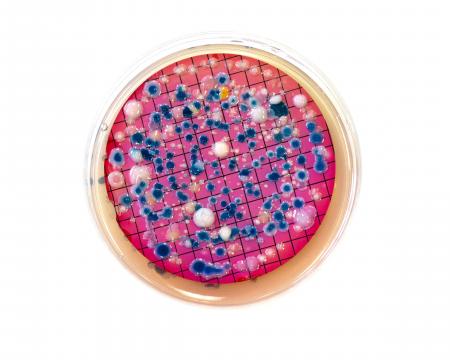 Escherichia coli colonies