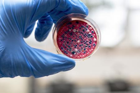 Escherichia coli colonies