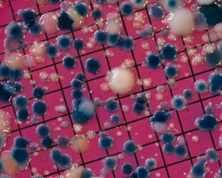 Escherichia coli colonies