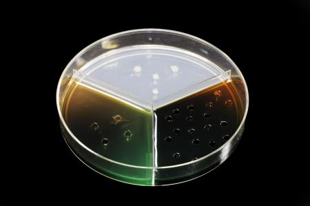 Food Safety Antigen Antibody Test