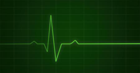 Heartbeat Monitor Concept