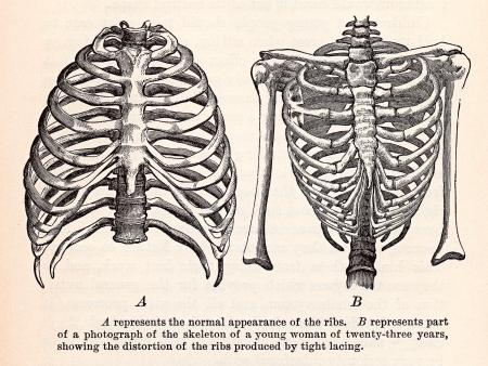 Human Ribcages, Circa 1911