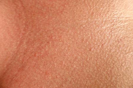 Human skin