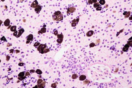 Liver Cells Microscope View