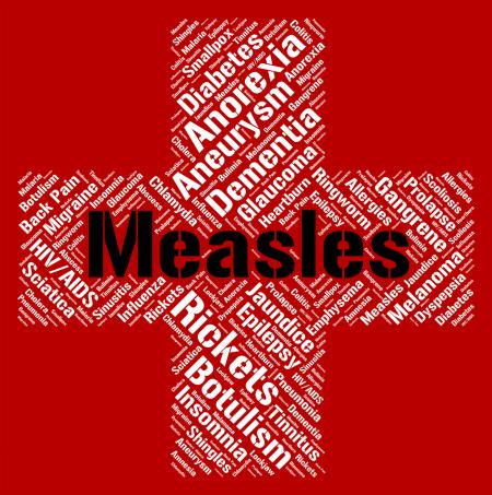 Measles Word Means Kopliks Spots And Ailment