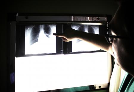 Medical doctor pointing to an x-ray image