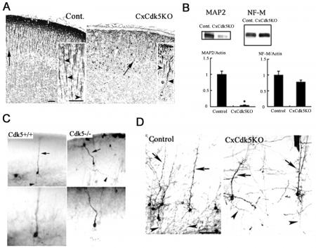 Multipolar Neuron Texture